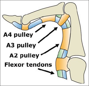 Tech Tips: Avoid Finger Blowouts Tech Tips: Avoid Finger Blowouts
