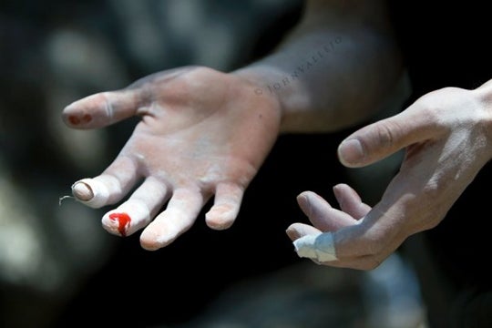 AlanBloodyFinger5997_5113.jpg Self-explanatory. Photo by John Vallejo johnclimbrok.blogspot.com