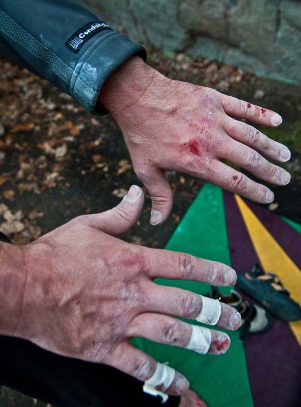 DSC_1366_Edit_Jpeg_2_10385.jpg Thrashed—Ben Brown's hands after a good day