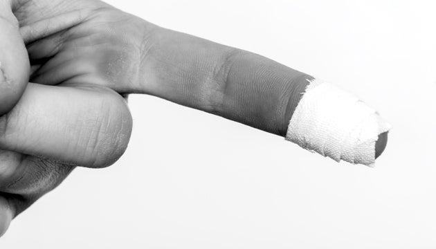 skin6.jpg Rock Climbing Finger Taping Skin Care
