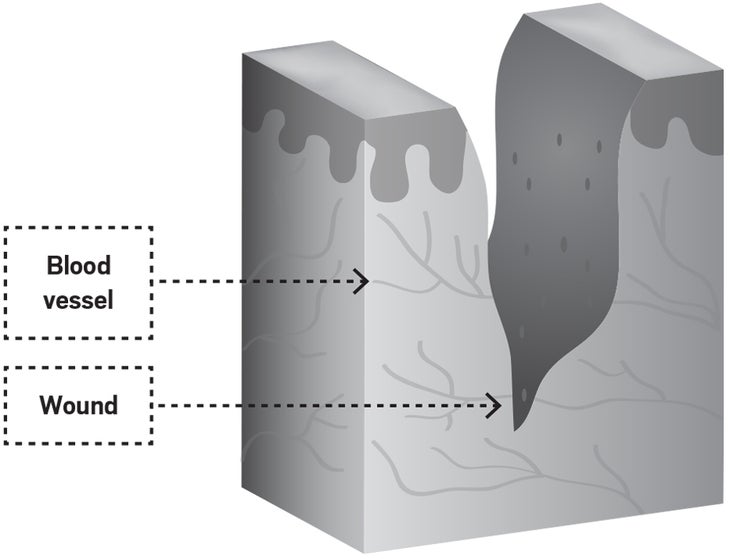 Wound1.jpg Skin healing cycle illustration