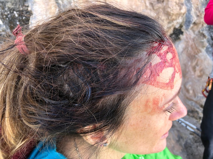 Headwound None