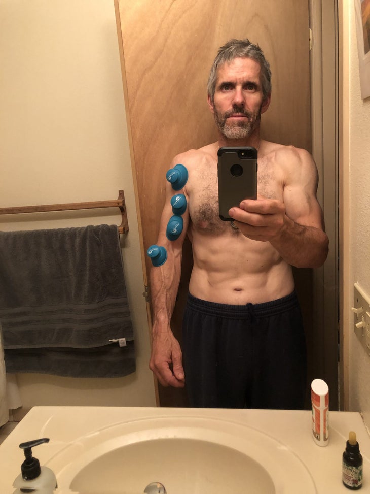 Wave Tools Therapy Riptide Sport Cupping Set