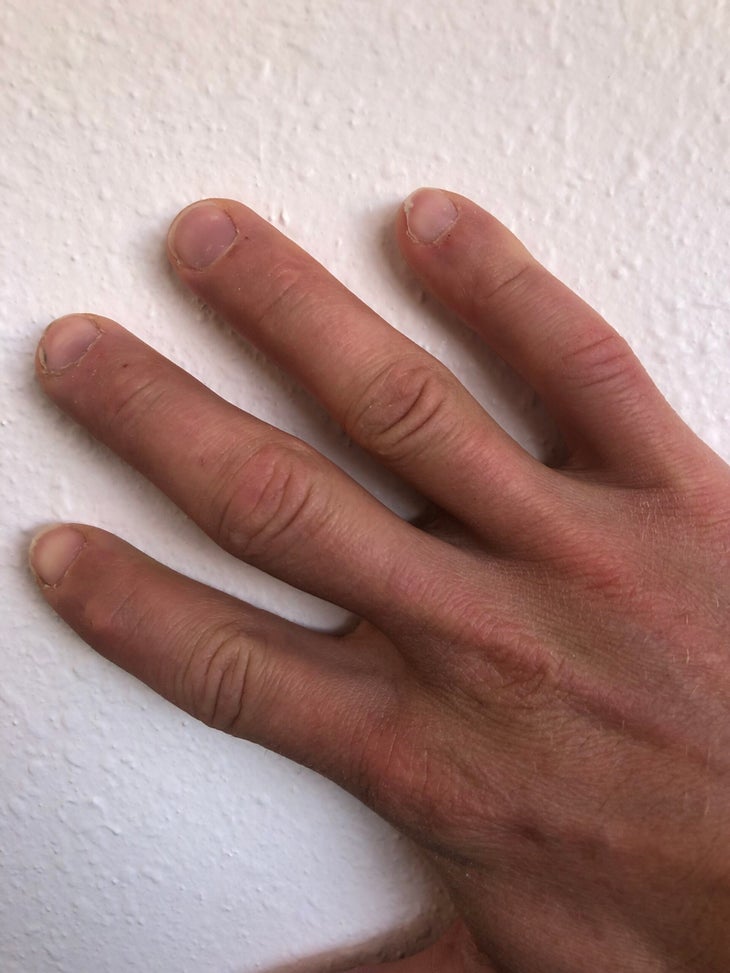 Creaky fingers
